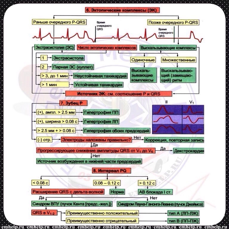 Шпаргалки скорой. Супер шпаргалка по ЭКГ. ЭКГ шпора в таблице. Шпаргалка по ЭКГ для скорой помощи. EMHELP шпаргалки ЭКГ.